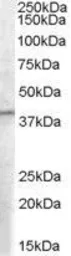 Anti-PCID1 antibody, C-term used in Western Blot (WB). GTX89456