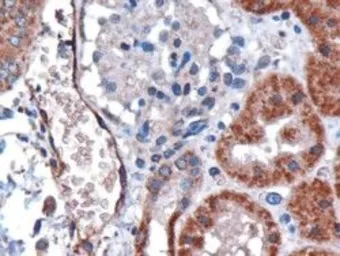 Anti-DARC antibody, N-term used in IHC (Paraffin sections) (IHC-P). GTX89467