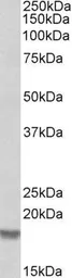 Anti-Cofilin 2 antibody, C-term used in Western Blot (WB). GTX89482