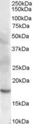 Anti-Cofilin 2 antibody, C-term used in Western Blot (WB). GTX89482