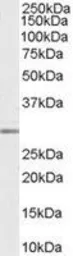 Anti-MMP7 antibody, C-term used in Western Blot (WB). GTX89487