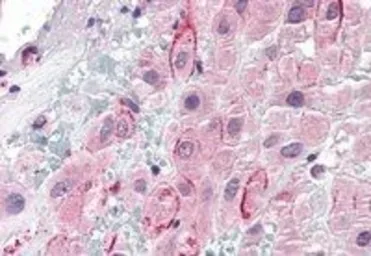 Anti-Osteopontin antibody, C-term used in IHC (Paraffin sections) (IHC-P). GTX89519