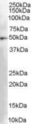 Anti-DOPA Decarboxylase antibody, C-term used in Western Blot (WB). GTX89527