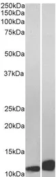 Anti-MIF antibody, C-term used in Western Blot (WB). GTX89535