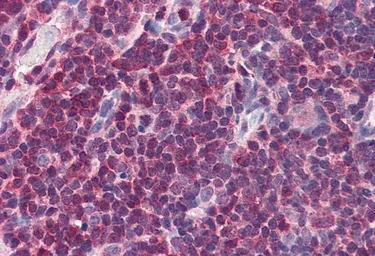 Anti-MIF antibody, C-term used in IHC (Paraffin sections) (IHC-P). GTX89535