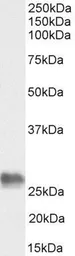 Anti-BAG2 antibody, C-term used in Western Blot (WB). GTX89538
