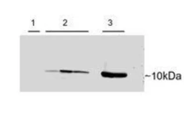 Anti-Parvalbumin antibody, C-term used in Western Blot (WB). GTX89558