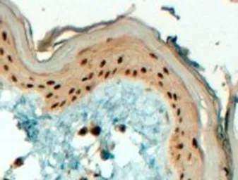 Anti-AP2 gamma antibody, C-term used in IHC (Paraffin sections) (IHC-P). GTX89567