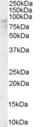Anti-OSBP antibody, Internal used in Western Blot (WB). GTX89571