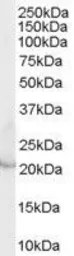 Anti-Lipocalin-2 antibody, Internal used in Western Blot (WB). GTX89572