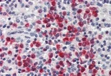 Anti-Lipocalin-2 antibody, Internal used in IHC (Paraffin sections) (IHC-P). GTX89572