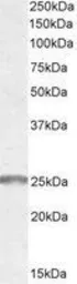 Anti-Synaptogyrin 2 antibody, Internal used in Western Blot (WB). GTX89573