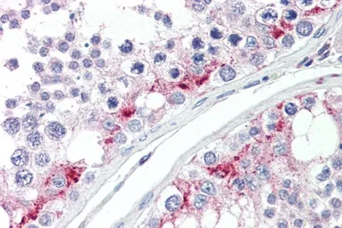 Anti-ZDHHC17 antibody, C-term used in IHC (Paraffin sections) (IHC-P). GTX89582