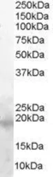 Anti-Survivin antibody, C-term used in Western Blot (WB). GTX89625