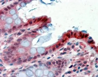 Anti-15-PGDH antibody, C-term used in IHC (Paraffin sections) (IHC-P). GTX89634