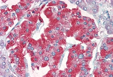 Anti-VMAT2 antibody, C-term used in IHC (Paraffin sections) (IHC-P). GTX89638
