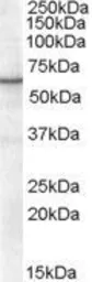Anti-Retinoid X Receptor alpha antibody, Internal used in Western Blot (WB). GTX89652