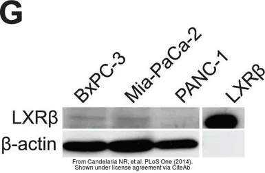 Anti-LXR beta antibody, N-term used in Western Blot (WB). GTX89661