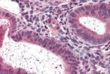 Anti-LXR beta antibody, N-term used in IHC (Paraffin sections) (IHC-P). GTX89661