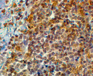 Anti-EFHD2 antibody, C-term used in IHC (Paraffin sections) (IHC-P). GTX89662