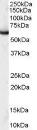 Anti-PUF60 antibody, C-term used in Western Blot (WB). GTX89681