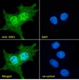Anti-DKK1 antibody, C-term used in Immunocytochemistry/ Immunofluorescence (ICC/IF). GTX89683