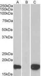 Anti-PHLDA3 antibody, C-term used in Western Blot (WB). GTX89684
