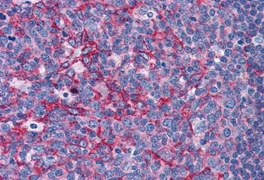 Anti-Flotillin 2 antibody, C-term used in IHC (Paraffin sections) (IHC-P). GTX89704