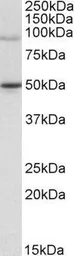 Anti-WHIP antibody, C-term used in Western Blot (WB). GTX89707