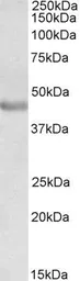 Anti-PAX3 antibody, N-term used in Western Blot (WB). GTX89743