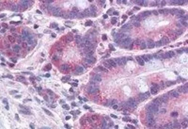 Anti-FACL4 antibody, C-term used in IHC (Paraffin sections) (IHC-P). GTX89766