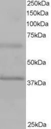 Anti-BPOZ antibody, C-term used in Western Blot (WB). GTX89774