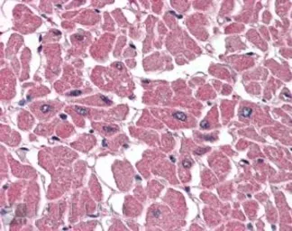 Anti-BPOZ antibody, C-term used in IHC (Paraffin sections) (IHC-P). GTX89774