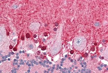 Anti-BPOZ antibody, C-term used in IHC (Paraffin sections) (IHC-P). GTX89774