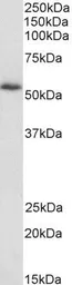 Anti-HIP55 antibody, N-term used in Western Blot (WB). GTX89787