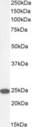 Anti-Transgelin antibody, C-term used in Western Blot (WB). GTX89789