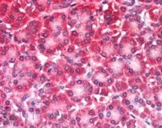 Anti-CARD6 antibody, N-term used in IHC (Paraffin sections) (IHC-P). GTX89808