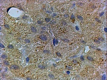 Anti-PEX13 antibody, C-term used in IHC (Paraffin sections) (IHC-P). GTX89859