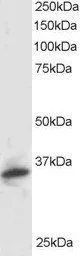 Anti-PSMF1 (Isoform 1) antibody, C-term used in Western Blot (WB). GTX89875