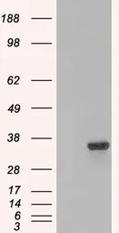Anti-PSMF1 (Isoform 1) antibody, C-term used in Western Blot (WB). GTX89875