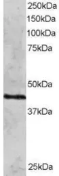 Anti-Rad51C antibody, N-term used in Western Blot (WB). GTX89889