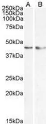Anti-KLF15 antibody, N-term used in Western Blot (WB). GTX89919
