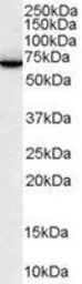 Anti-SWAP70 antibody, C-term used in Western Blot (WB). GTX89933