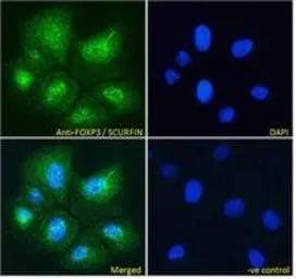 Anti-FOXP3 antibody, C-term used in Immunocytochemistry/ Immunofluorescence (ICC/IF). GTX89934