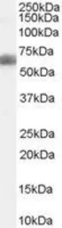 Anti-DKK3 antibody, C-term used in Western Blot (WB). GTX89935