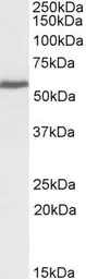 Anti-PRPF31 antibody, C-term used in Western Blot (WB). GTX89936