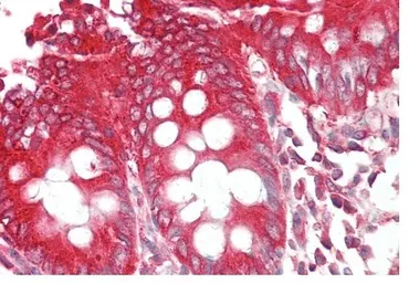 Anti-Bif-1 antibody, C-term used in IHC (Paraffin sections) (IHC-P). GTX89961