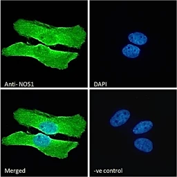 Anti-nNOS antibody, C-term used in Immunocytochemistry/ Immunofluorescence (ICC/IF). GTX89962