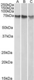 Anti-ATF2 antibody, C-term used in Western Blot (WB). GTX89979
