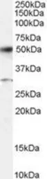 Anti-ATF2 antibody, C-term used in Western Blot (WB). GTX89979
